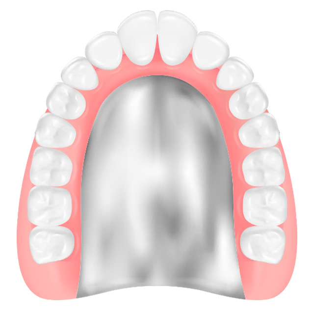 チタン床義歯